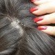 How to Get Rid of an Itchy Scalp